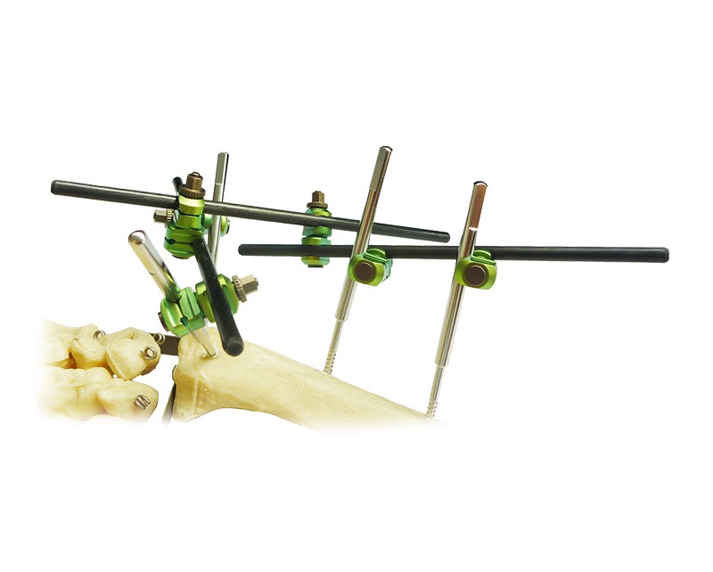 Modular-external-fixation-system-supplies-cameroon2 Modular-external-fixation-system-supplies-cameroon